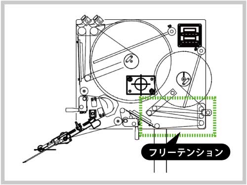 フリーテンション